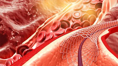 3D animated image of heart valves.