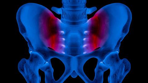 3D animated image of the Sacroiliac Joint.