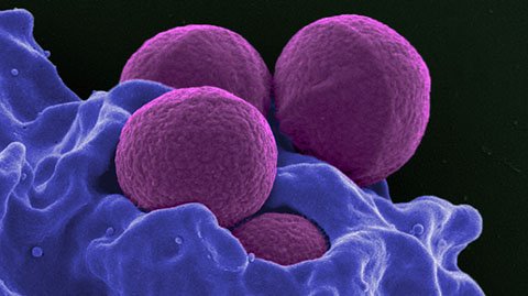 MRSA molecules seen under a microscope